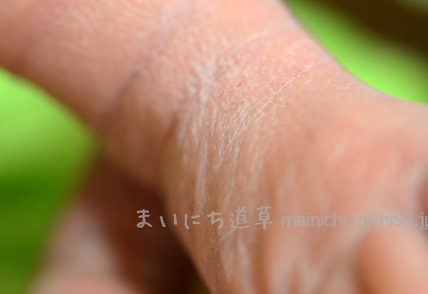 乾燥ではなく、老化した胎盤が原因 乾燥ではなく、老化した胎盤が原因